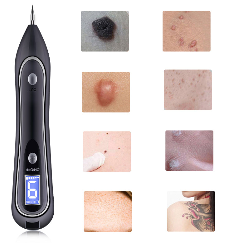 FY-104 Pain-free mole removal pen Skin beauty tools Mole removal pen