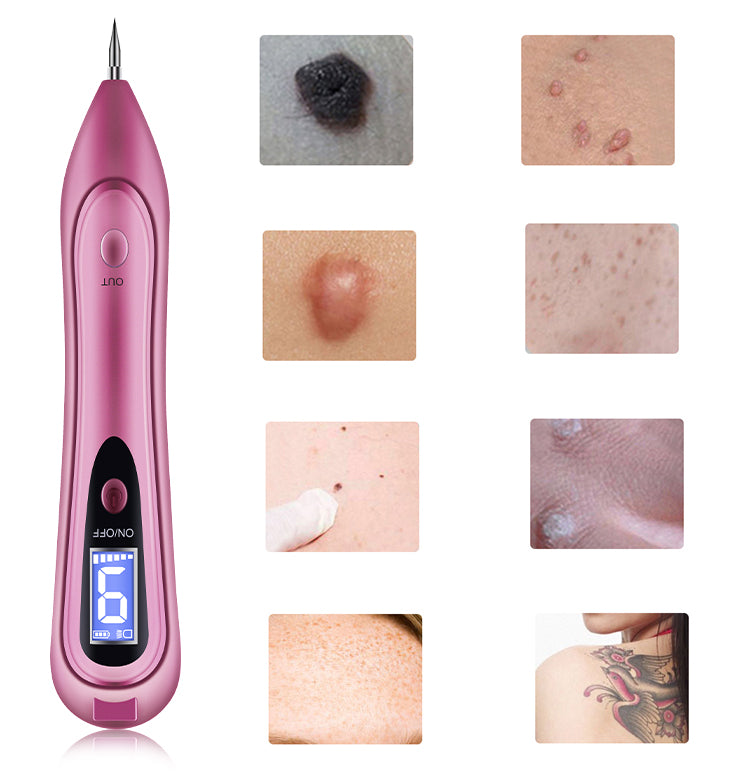 FY-104 Pain-free mole removal pen Skin beauty tools Mole removal pen