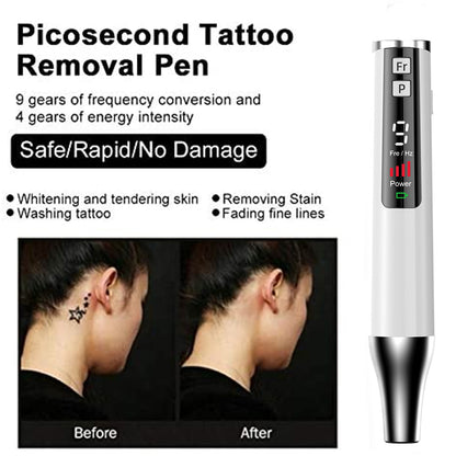 The Ultimate Home Tattoo and Pigment Removal Solution: PAKISS Picosecond Laser Pen - The Magic Tool for Skin Renewal.